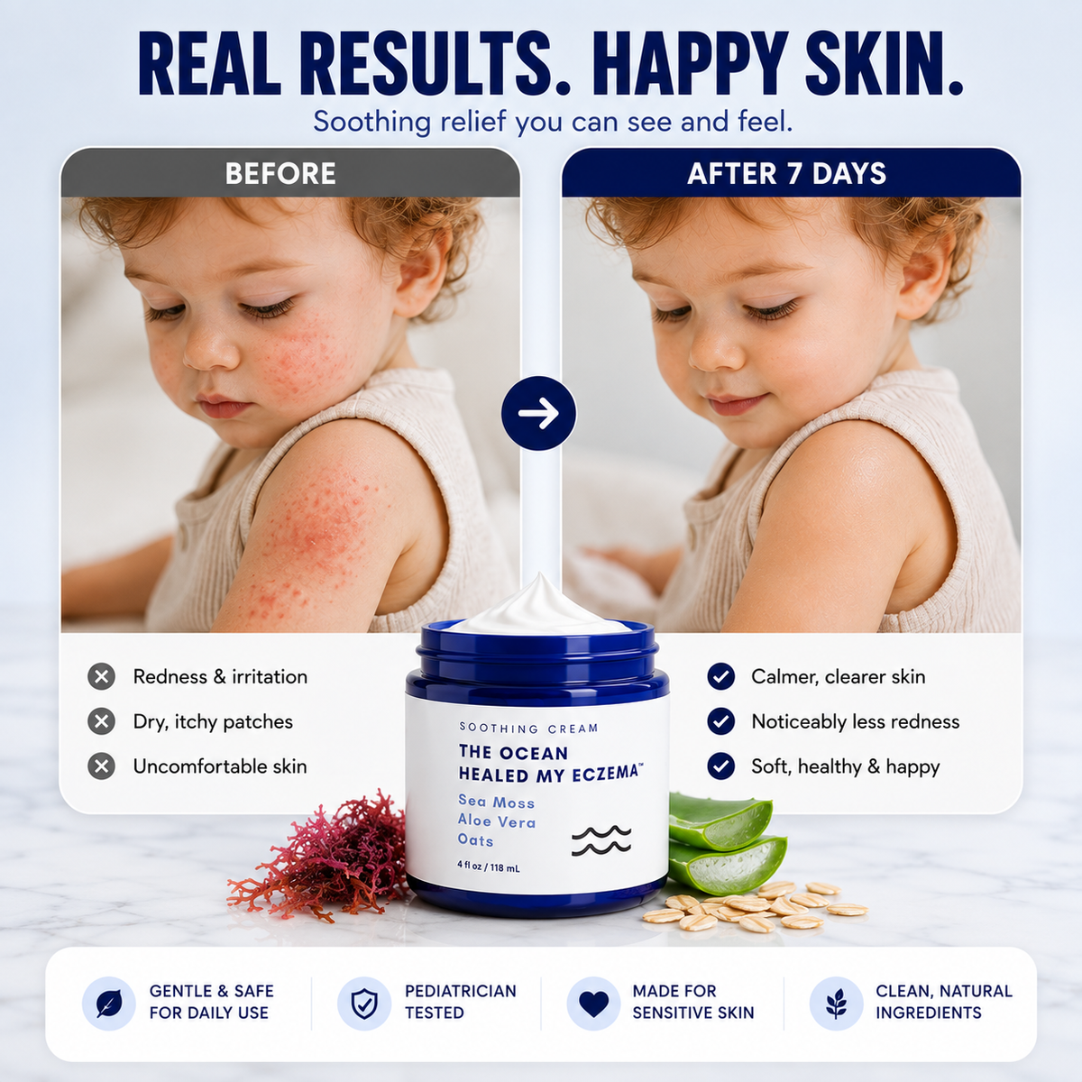 Ocean Relief™ Intensive Sea Moss Soothing Cream