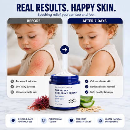 Ocean Relief™ Intensive Sea Moss Soothing Cream