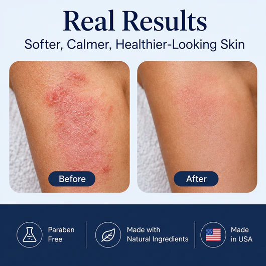 Ocean Relief™ Intensive Sea Moss Soothing Cream