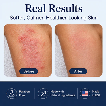 Ocean Relief™ Intensive Sea Moss Soothing Cream